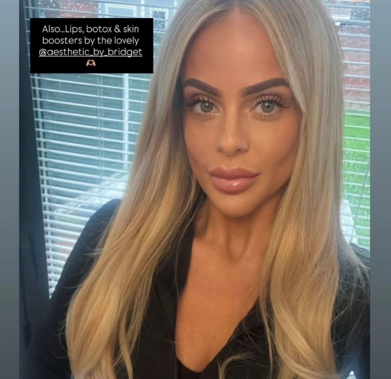 Anti-wrinkle Treatment